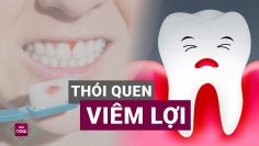 Cứ hôi miệng là lại phải thắc mắc tại sao: Đừng băn khoăn nữa, nguyên nhân ở đây! | VTC Now