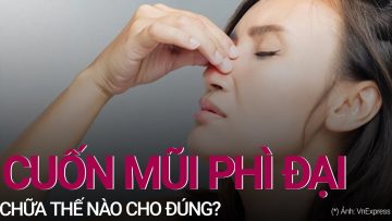 Cuốn mũi phì đại: Chữa thế nào cho đúng? | VTC Now