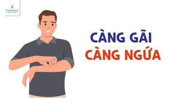 Da bị ngứa càng gãi càng ngứa – Làm thế nào?