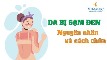 Da bị sạm đen- Nguyên nhân và cách chữa