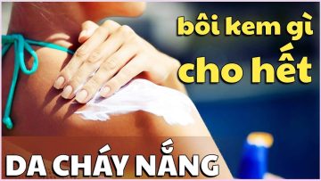 Da cháy nắng, bôi kem gì cho hết?| BS Phạm Đức Thọ, BV Vinmec Times City