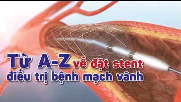 Đặt stent mạch vành được bao lâu? Tái hẹp mạch vành thì làm thế nào?