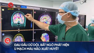 Đau đầu dữ dội, bất ngờ phát hiện u mạch máu não xuất huyết | Truyền hình Quốc hội Việt Nam