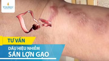 Dấu hiệu khi nhiễm sán lợn | Sán lợn có nguy hiểm không?