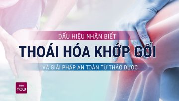 Dấu hiệu nhận biết thoái hóa khớp gối và giải pháp đáng quan tâm từ thảo dược | VTC Now