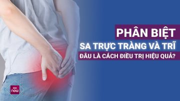 Dấu hiệu phân biệt sa trực tràng và trĩ một cách rõ ràng nhất | VTC Now