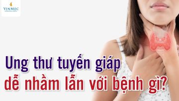 Dấu hiệu ung thư tuyến giáp dễ nhầm lẫn với bệnh gì?