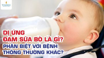 Dị ứng đạm sữa bò là gì? Ths, BS Nguyễn Duy Bộ – Vinmec Times City (Hà Nội)