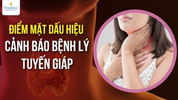 Điểm mặt dấu hiệu cảnh bệnh lý tuyến giáp | BS Lê Thị My, BV Vinmec Times City