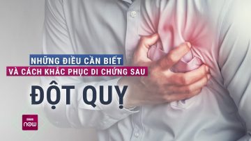 Đột quỵ đến bất thình lình: Làm sao nhận biết, khắc phục di chứng như thế nào? | VTC Now