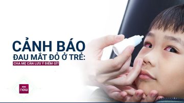 Đừng chủ quan với đau mắt đỏ ở trẻ, chăm sóc không đúng cách bệnh sẽ nặng, thậm chí mù lòa | VTC Now