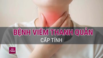 Đừng chủ quan với viêm thanh quản, biến chứng nguy hiểm hơn bạn nghĩ | VTC Now