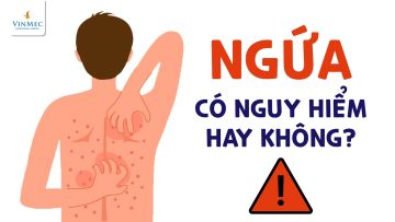 Đừng coi thường ngứa – coi chừng ung thư