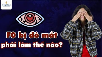 F0 COVID bị đỏ mắt, phải làm thế nào?