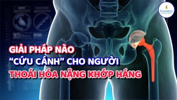 Giải pháp cứu cánh cho người bệnh thoái hóa nặng khớp háng|BS Phạm Trung Hiếu,BV Vinmec Times City