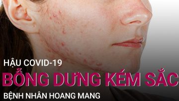 Hậu Covid-19, bệnh nhân hoang mang vì bỗng dưng kém sắc | VTC Now