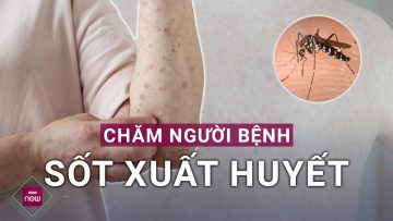 Hãy cẩn trọng: Dịch bệnh có thể xuất hiện nhiều hơn sau bão lũ đặc biệt là sốt xuất huyết | VTC Now