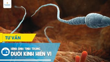 Hình ảnh tinh trùng dưới kính hiển vi