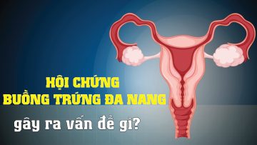 Hội chứng buồng trứng đa nang gây ra vấn đề gì?