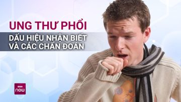 “Hung thần” ung thư phổi: Bác sĩ tư vấn làm sao để phát hiện sớm | VTC Now