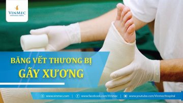 Hướng dẫn băng vết thương khi nghi ngờ bị gãy xương