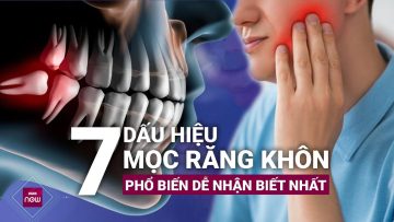 Khổ sở vì mọc răng khôn: Nên quan tâm tới 7 dấu hiệu phổ biến, dễ nhận biết này | VTC Now