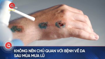 Không nên chủ quan với bệnh về da sau mùa mưa lũ | Truyền hình Quốc hội Việt Nam