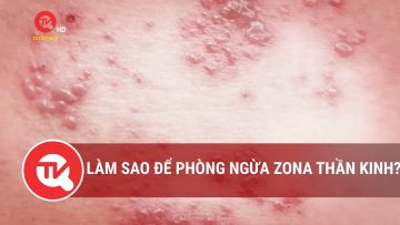 Làm sao để phòng ngừa zona thần kinh? | Truyền hình Quốc hội Việt Nam