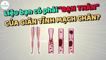 Liệu bạn có phải “bạn thân” của giãn tĩnh mạch chân?| BS Lê Đức Hiệp, BV Vinmec Times City