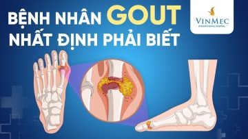 Lời khuyên bệnh nhân GOUT nên thực hiện ngay | BS Trần Thị Tuyết Nhung, BV Vinmec Times City