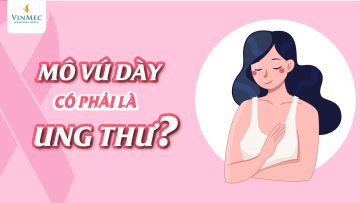 Mô vú dày có phải là ung thư?