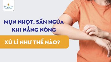 Mụn nhọt, sẩn ngứa khi nắng nóng cần xử lý như thế nào?| ThS, BS Nguyễn Duy Bộ, BV Vinmec Times City