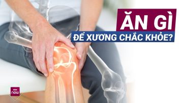 Ngạc nhiên với những thực phẩm đơn giản ăn hàng ngày giúp xương chắc khỏe, giảm đau nhức | VTC Now