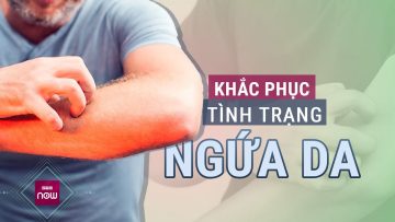 Ngứa da không dứt: Cảnh báo 3 sai lầm chết người khi gãi vì ngứa da | VTC Now