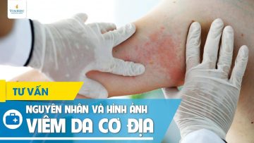 Nguyên nhân và hình ảnh viêm da cơ địa