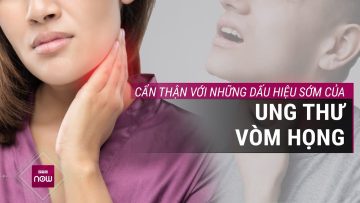 Nhận biết những dấu hiệu sớm của ung thư vòm họng | VTC Now