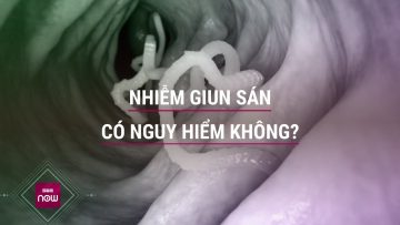 Nhiễm giun sán có thể gây nguy hiểm tới sức khỏe và tính mạng? | VTC Now