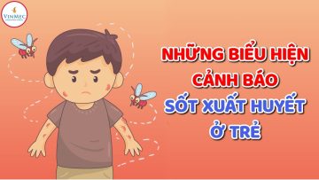 Những biểu hiện cảnh báo sốt xuất huyết ở trẻ