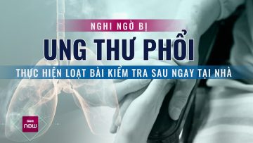 Những dấu hiệu cảnh báo về nguy cơ mắc căn bệnh ung thư phổi | VTC Now