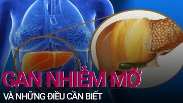 Những điều cần biết về bệnh gan nhiễm mỡ | VTC Now