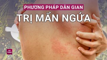 Những liệu pháp dân gian trị mẩn ngứa vừa hiệu quả, vừa an toàn, không kém tân dược | VTC Now