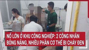 Nổ bình hơi ở Bình Thuận khiến 2 công nhân bỏng nặng, nhiều phần cơ thể bị cháy đen