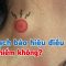 Nổi hạch báo hiệu điều gì? Nguy hiểm không?