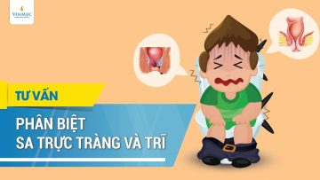 Phân biệt sa trực tràng và trĩ