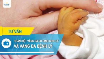 Phân biệt vàng da sơ sinh sinh lý và vàng da bệnh lý