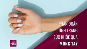 Phán đoán tình trạng sức khỏe qua … móng tay | VTC Now