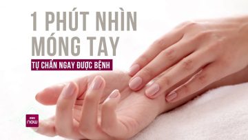 Phát hiện móng tay có những biểu hiện này, bạn hãy cẩn thận về tình trạng sức khỏe | VTC Now