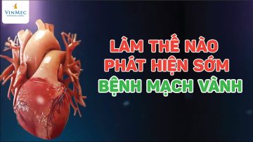 Phát hiện sớm bệnh mạch vành bằng cách nào?