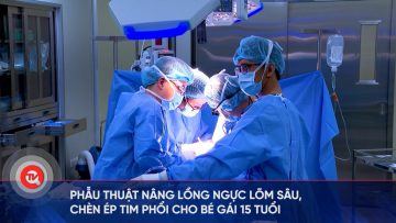 Phẫu thuật nâng lồng ngực lõm sâu, chèn ép tim phổi cho bé gái 15 tuổi