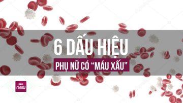 Phụ nữ có máu xấu” biểu hiện qua 6 dấu hiệu này, cần làm ngay 3 việc để lọc máu gấp | VTC Now